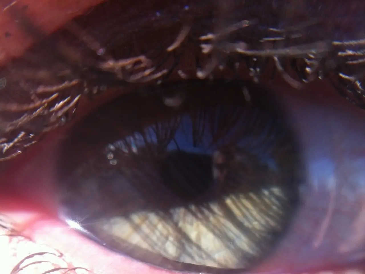 Inflammation of the tear sac: Triggers, signs, and remedies