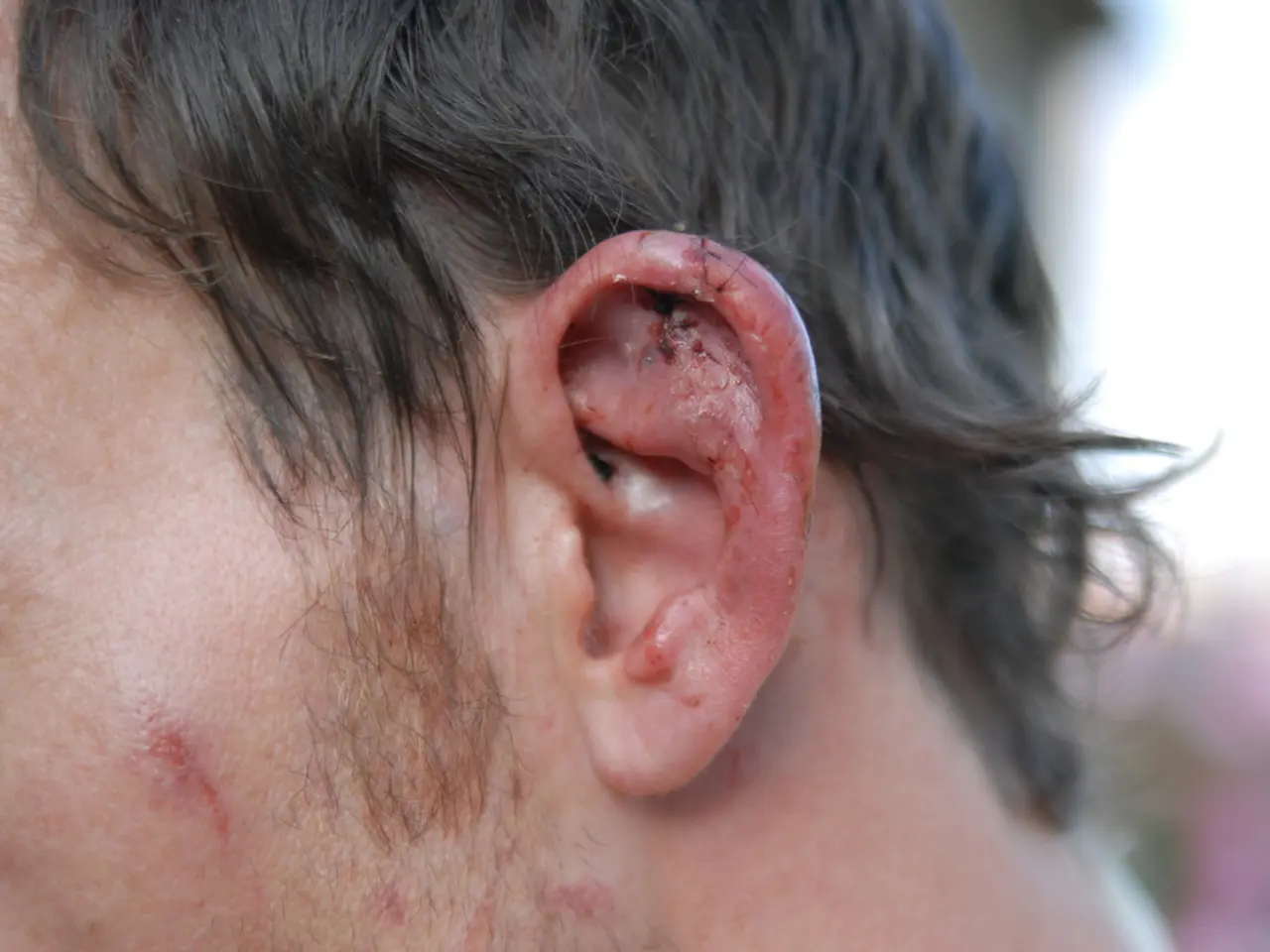 What is the critical point for a skull lump to be concerning?