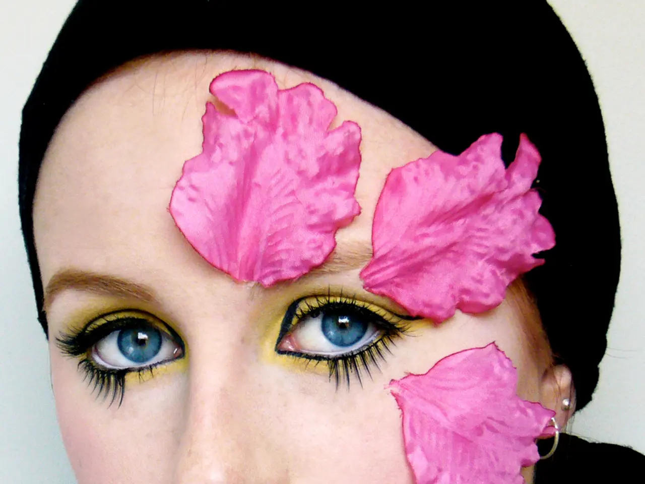 Cosmetic surgeries gaining popularity in Afghanistan