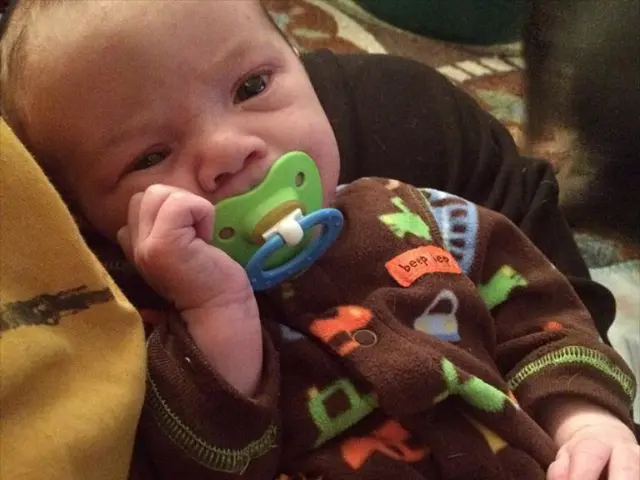 Baby and Toddler Lip Ties: Symptoms and Remedies