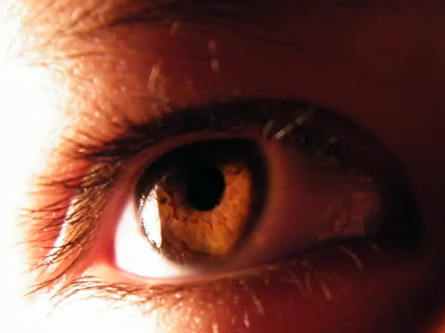 Can Hyperpigmentation Fade Away?