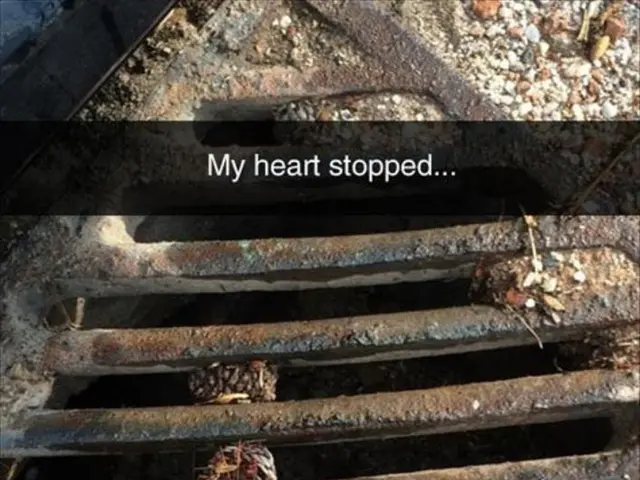 Myocardial Segment ST Depression: Meaning, Causes, Remedies