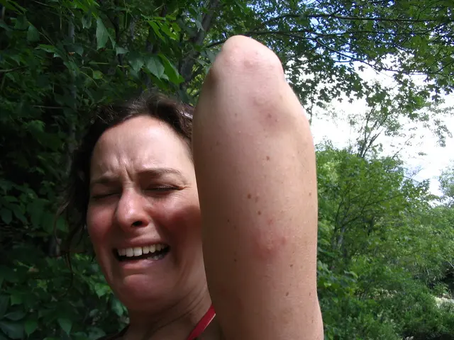 Common, Mild, and Potential Severe Effects of Wellbutrin Treatment