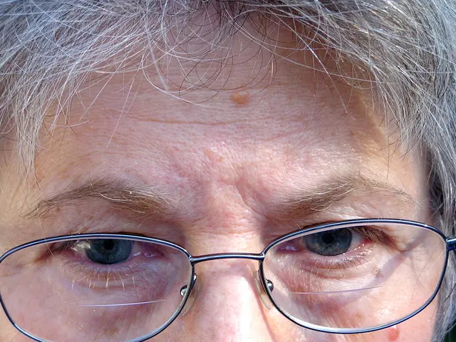 Methods for Treating Myopia: Is a Permanent Solution Attainable?